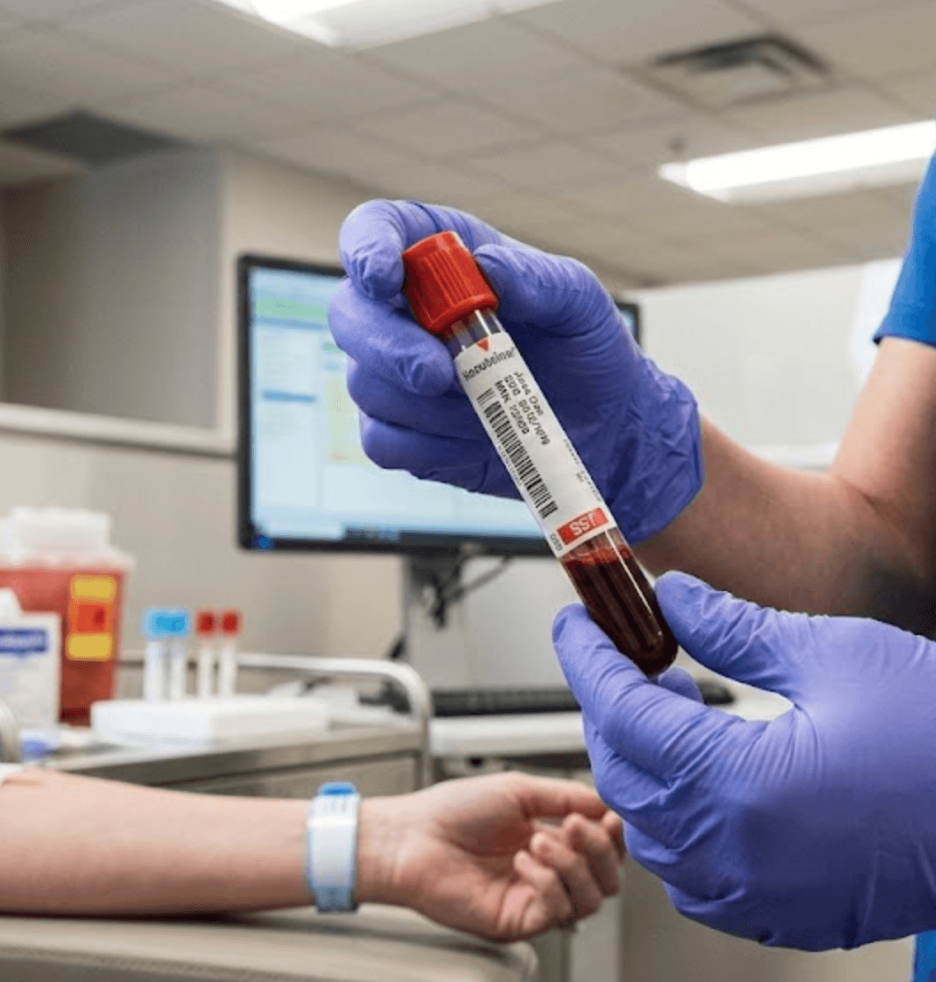 Blood Testing vs. Environmental Testing: Which Comes First?